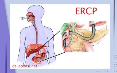 ERCP چیست و برای تشخیص چه بیماری هایی استفاده می شود؟