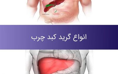 انواع گرید کبد چرب چه تفاوت هایی باهم دارند؟