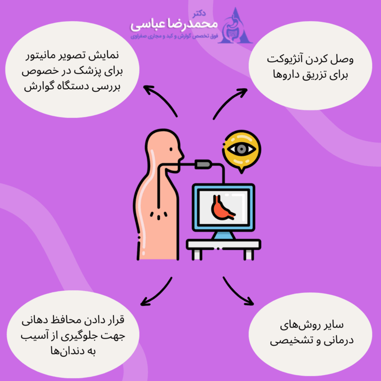 فرایند آندوسکوپی